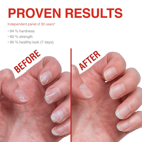 Probelle Nail Strengthener and Growth, Natural Nail Strengthening Clear Polish, Repair Treatment for Damaged and Thin