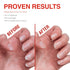 Probelle Nail Strengthener and Growth, Natural Nail Strengthening Clear Polish, Repair Treatment for Damaged and Thin