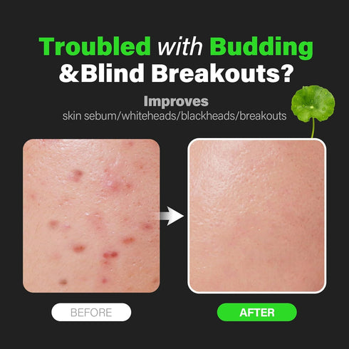 NOSCA9 Trouble Serum S | Hydrating Cica Kbeauty Serum with Centella Asiatica, Panthenol & Apple Extract (1.01 Fl Oz)