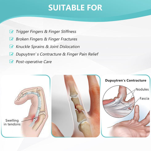 2 Finger Splint Adjustable Trigger Finger Support, Full Hand and Wrist Brace for Sprains, Arthritis (L/XL)