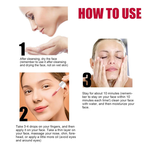 Peeling Solution AHA 30% + BHA 2% - Exfoliating Facial Serum Chemical Peel for Face, Reduces Blemishes and Fine Lines