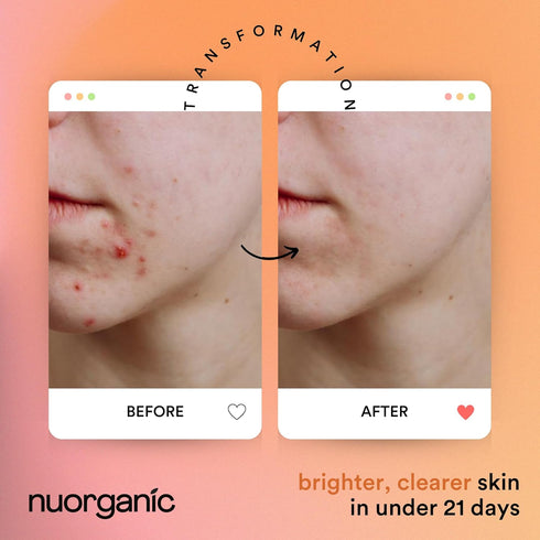 nuorganic Turmeric Face Mask - Soothing, Acne Clearing, Exfoliating, Pore Refining - Airtight Squeezy Tube, 12 Months