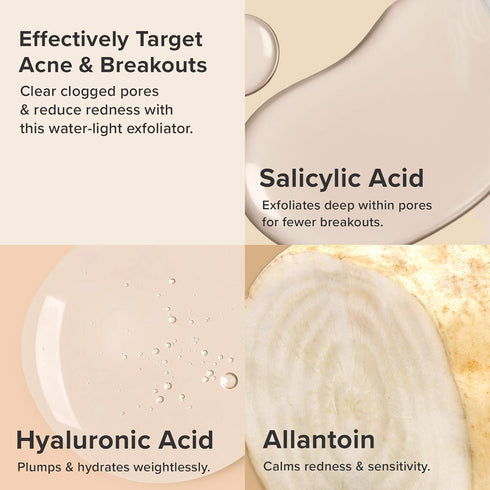 Paula's Choice CLEAR Anti-Redness Exfoliating Solution, 2% Salicylic Acid Exfoliant, 4 Fl. Oz, Fragrance-Free for Acne