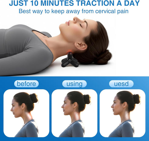 teepten Occipital Release Tool, Release Tool for Neck for Headache Relief, Deep Nerve Release Tool with Acupressure