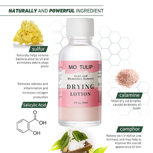 MO TULIP Acne Drying Lotion - Overnight Acne Spot Treatment for Face and Body, 1OZ Pimple Lotion