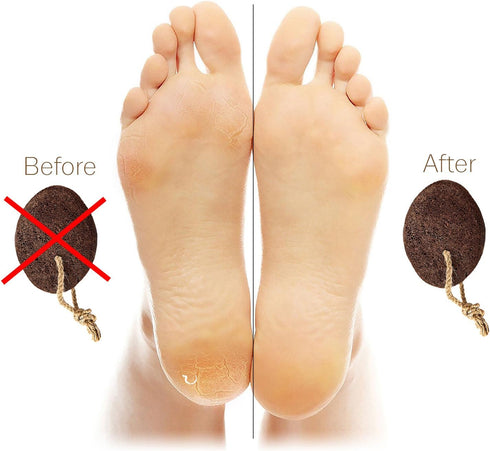 Natural Earth Lava Pumice Stones for Feet - Pack of 2 - Callus Remover for Heels, Palm, Foot Care