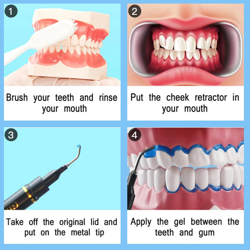 Dental Gingival Barrier Protection Gel, 10PCS, 3ML Gum Protector Gel for Teeth Whitening