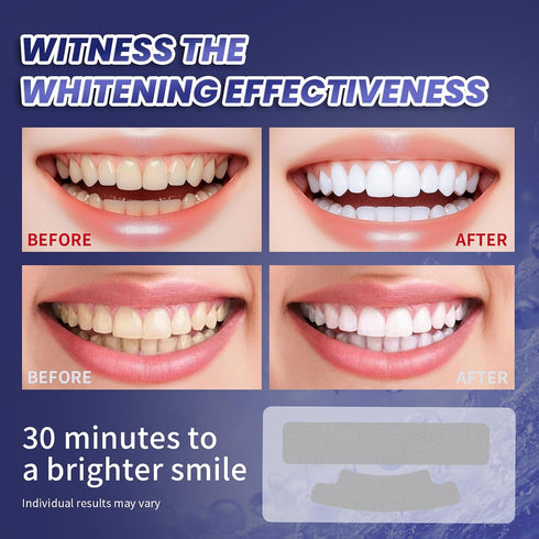 Lanlwos 28 7 Teeth Whitening Strips Stripes - Days Whitening Sensitive Teeth whitening Strips, Peroxide Free, Enamel