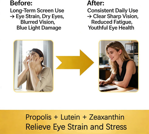 Magnixa Gummies, 60 Count lhanile Clarity Vision Helps Reduce Screen Strain