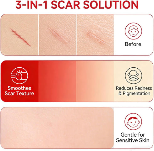 Scar Soothing Cream & Smoothing Cream for Scars - Gentle Care for Sensitive Skin, Helps Improve Appearance of Scars