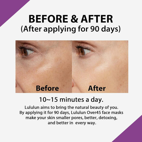 Lululun 32pc Anti-aging Hydrating Facial Sheet Mask Pack, Moisturizing Skin Care for Beauty, Over 45, Iris Blue