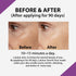 Lululun 32pc Anti-aging Hydrating Facial Sheet Mask Pack, Moisturizing Skin Care for Beauty, Over 45, Iris Blue