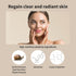 BENTON Snail Bee Ultimate Serum Plus 35ml, Nourishing Facial Serum with Snail Secretion Filtrate and Bee Venom