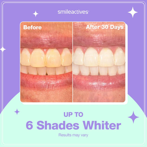 Smileactives Teeth Whitening Pen, Fast Tooth Whitener & Stain Remover, Winterberry Flavor, 0.11 fl oz, Travel Pen
