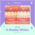 Smileactives Teeth Whitening Pen, Fast Tooth Whitener, Stain Remover, Travel Pen, Ultramint Flavor, 2 Pack