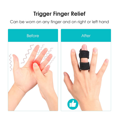 Cozyhealth Finger Splint (2 Pack), Universal Finger Straightener for Arthritis Pain and Support