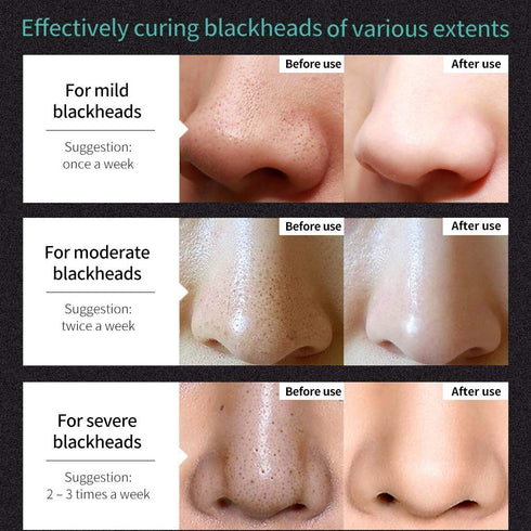 MIESCHER Blackhead Removal Mask - Peel Off Facial Black Mask for Deep Pore Cleansing and Skin Brightening