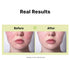 10% Azelaic Acid Serum with Niacinamide, Salicylic Acid, Rosacea Treatment for Face Redness Relief, 1Fl Oz