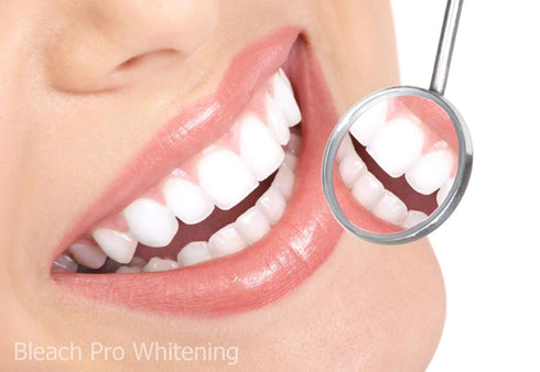 Teeth Whitening Gel Syringe Dispensers, 22% Carbamide Peroxide, 10 Tooth Bleaching Gel 3ml Syringes