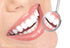 Teeth Whitening Gel Syringe Dispensers, 22% Carbamide Peroxide, 10 Tooth Bleaching Gel 3ml Syringes