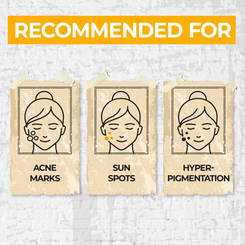 numbuzin No.5+ Vitamin Concentrated Serum, Glutathione & Vitamin Serum for Dark Spot, Korean Skincare (1.01fl.oz/30ml)