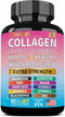 JTEVEweu Collagen Supplement - Type I, II, III, V and X - with