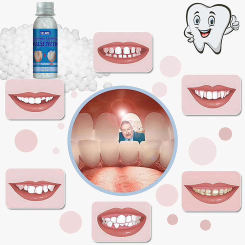 Yuehao 30Ml -1 New Temporary Tooth Temporary Repair Kit, DIY Play DoughSolidSimple-Temporary Fake Teeth Replacement Kit