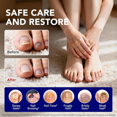 WRFAATGO 25% 4PCS Toenail Fungus Pen, Toenail Fungus Treatment Extra Strength, Undecylenic Acid for Fingernails