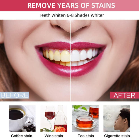 Pdoo Teeth Whitening Kit with LED Light for Sensitive Teeth, Fast Results for Brightening at Home, Teeth Whitening Gel