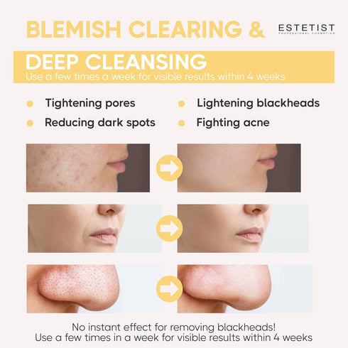 Turmeric Vitamin C Clay Face Mask Stick Set, Deep Pore Cleanser for Dark Spots and Oil Control, Gift Pack of 3