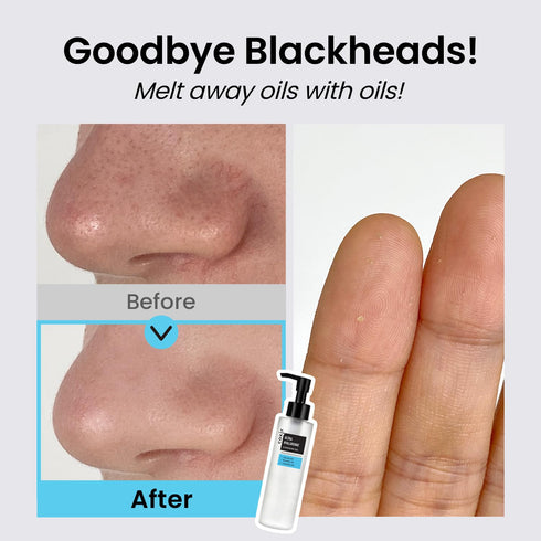 coxir ULTRA HYALURONIC CLEANSING OIL, Korean Facial Cleanser for Blackhead Removal with Hyaluronic Acid