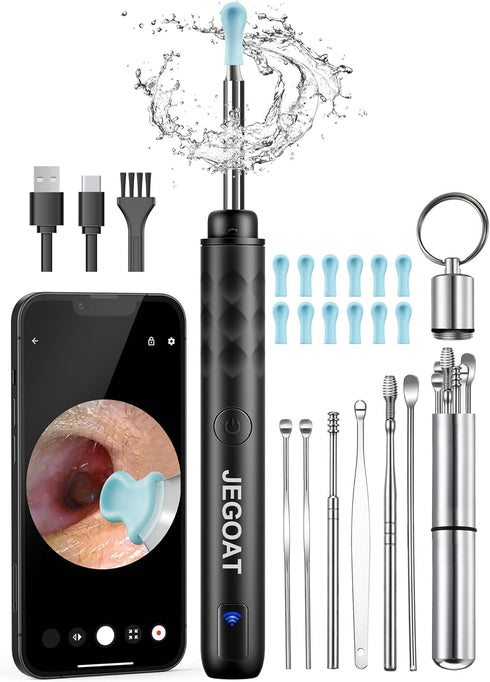 Ear Wax Removal Tool Camera, Ear Cleaner with 1296P HD Scope, 6 LED Lights and 12 Ear Picks