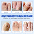 Mcukv 42PCS Nail Repair Patches for Damaged Toenails Overnight Nail Treatment with Natural Ingredients Extra Strength