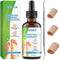 Ingrown Toenail Treatment Kit, Drops Reliever & Softener with Double-Sided Pedicure Tool for Men and Women