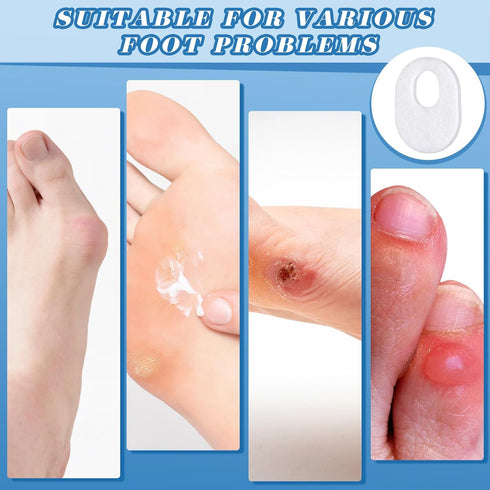 WILLBOND 30 Pcs Callus Pads, Soft Felt Oval Shape Corn Pads for Foot Pain Relief, Adhesive for Men and Women