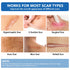 Niifawh Tape(1.6"x 120" Roll-3M) Clear Silicone Scar Sheets, Silicone Scar - Reusable, Soft & Medical Grade Adhesive