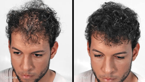 Volumizing Hair Fibers with Real Keratin for Thinning Hair - 60 Days+ Supply - Dermatologist Tested (Medium Brown)
