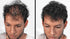 Volumizing Hair Fibers with Real Keratin for Thinning Hair - 60 Days+ Supply - Dermatologist Tested (Medium Brown)