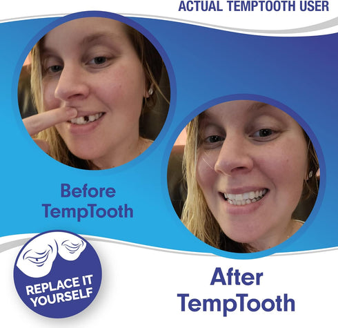 Temptooth #1 Seller, Trusted Patented Temporary Tooth Replacement Product