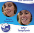 Temptooth #1 Seller, Trusted Patented Temporary Tooth Replacement Product