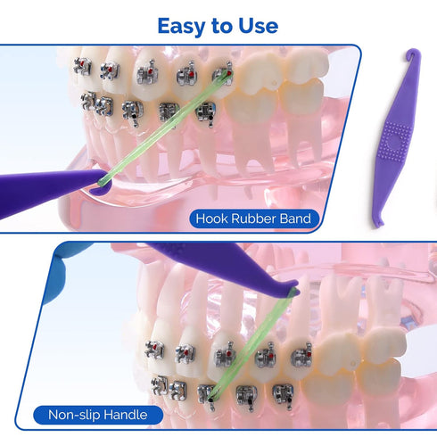 JMU Orthodontic Elastics 1/4 Medium, 500 Pack Non-Latex Intraoral Elastic Bands, Neon Dental Rubber Bands Made in USA