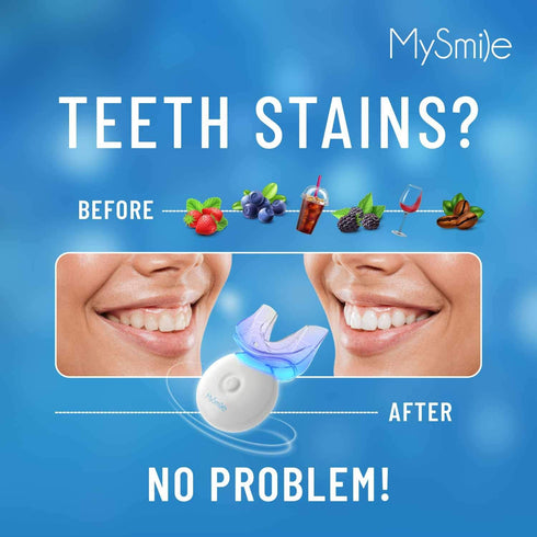 MySmile Teeth Whitening Kit with LED Light, 10 Min Fast Non-Sensitive Whitener, 3 Carbamide Peroxide Gel, Removes Stains