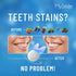 MySmile Teeth Whitening Kit with LED Light, 10 Min Fast Non-Sensitive Whitener, 3 Carbamide Peroxide Gel, Removes Stains