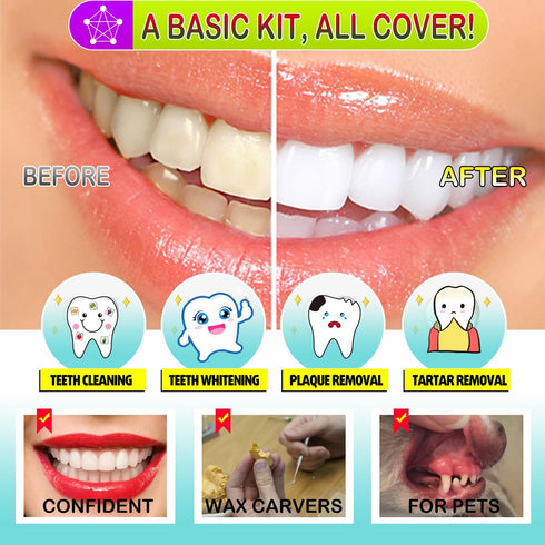 Dental Tools, Stainless Steel Teeth Cleaning Kit with Tooth Scraper and Plaque Remover