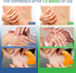 Set Hermon Antifungal Jock Itch Treatment Soap, Antifungal Cream, and Spray Complete Care for Jock Itch, Athletes Foot