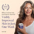 SKINTENSIVE Arnica Bruise Cream for Thin Skin, Moisturizing, Vitamin K C and E, 4 Oz