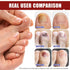 NIFEISHI (32pcs) Fungal Nail Patches for Toenails, Toenail Fungus Treatment Extra Strength for Overnight Toenail Care