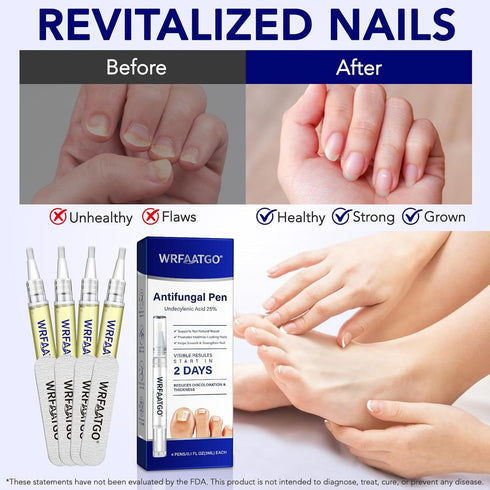 WRFAATGO 25% 4PCS Toenail Fungus Pen, Toenail Fungus Treatment Extra Strength, Undecylenic Acid for Fingernails