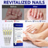 WRFAATGO 25% 4PCS Toenail Fungus Pen, Toenail Fungus Treatment Extra Strength, Undecylenic Acid for Fingernails