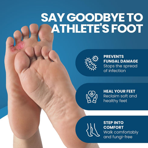 FUNGINIX AF Athletes Foot Cream - Topical Anti-Fungal Treatment (3 Tubes)